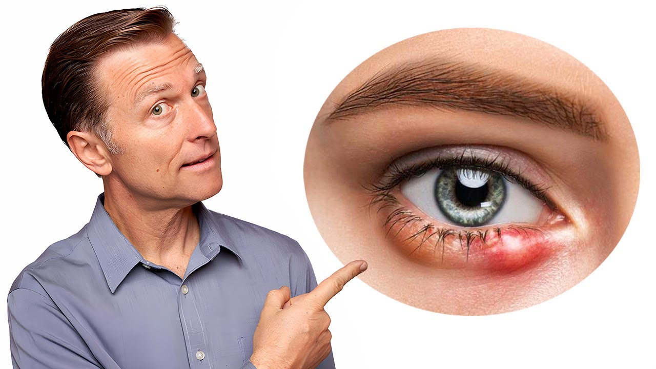 stye-fixed
